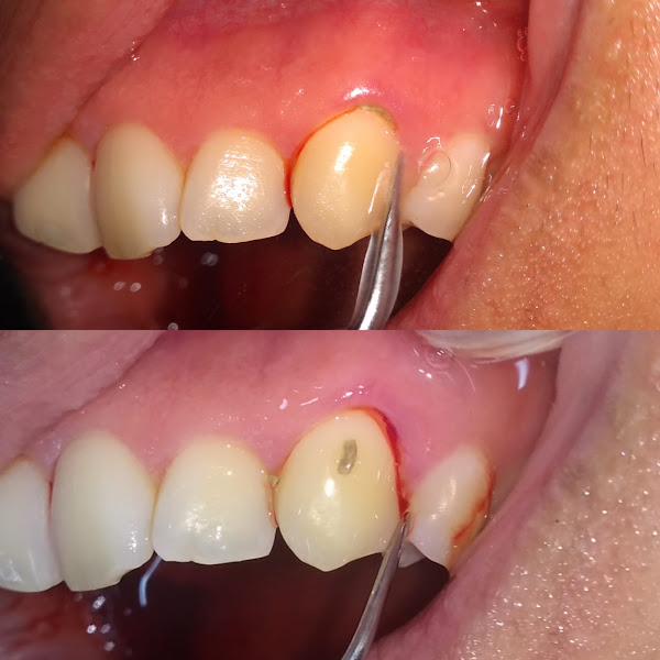 Foto 3 de Dr. Alicio/ Dentista
