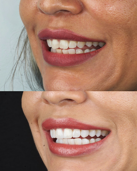 Foto 2 de Dr. Alipio Portilho Odontologia Estética