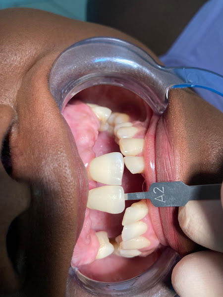 Foto 2 de Dr. Allan Martins Odontologia Reconstrutiva e Reabilitadora