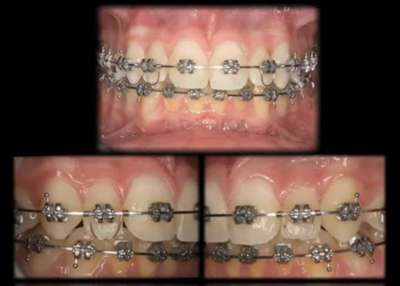 Foto 3 de Dr. Allan Martins Odontologia Reconstrutiva e Reabilitadora