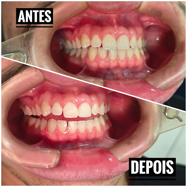 Foto 3 de DR. ALMIR FEITOSA (ODONTO MAIS) CONSULTÓRIO ODONTOLÓGICO