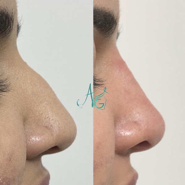 Foto 3 de Drª Ana Gabriela - Harmonização Orofacial & Odontologia Estética