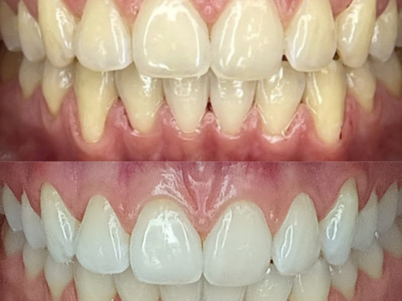 Foto 3 de Dr Ana Villela | Estética Dental e Ortodontia. Poços de Caldas