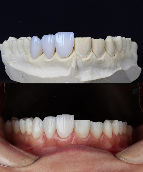 Foto 3 de Dr. Anderson Félix - Implantes Dentários