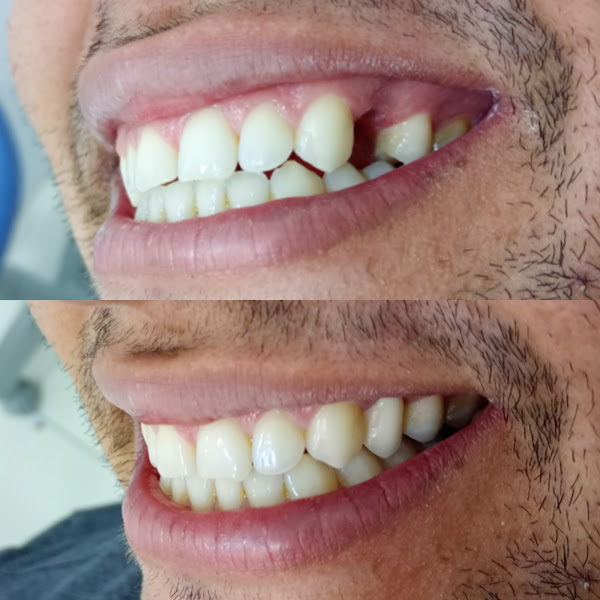 Foto 2 de Dr Anderson Gurgel - Reabilitação Oral e Estética