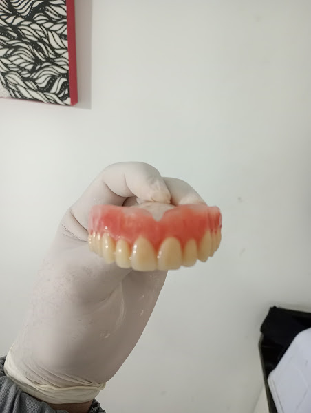 Foto 3 de Dr Anderson Gurgel - Reabilitação Oral e Estética