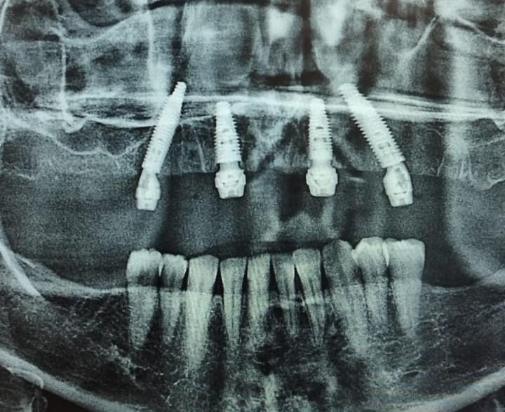 Foto 3 de Dr Anderson José , dentista de plantão 24 horas , dor dente , urgência e emergência
