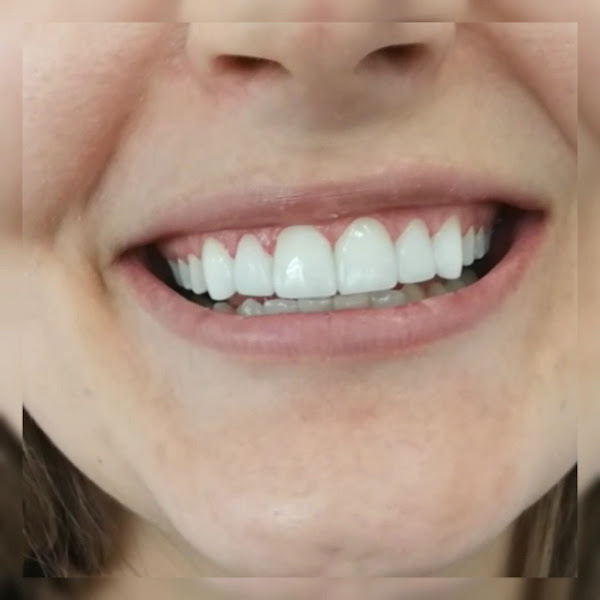 Foto 3 de Dr. André Cesa - Dentista