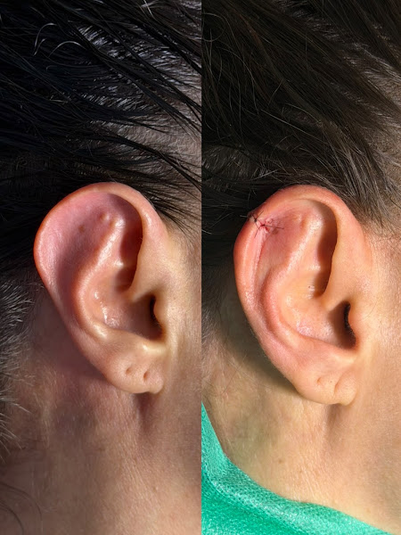 Foto 3 de Dr. André Mendes | Rinoplastia e Cirurgia Facial em Santos SP