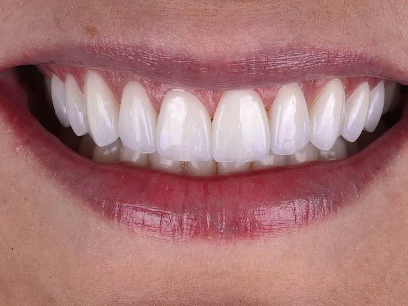 Foto de Dr. Andress Schneider - Lentes de Contato Cerâmicas