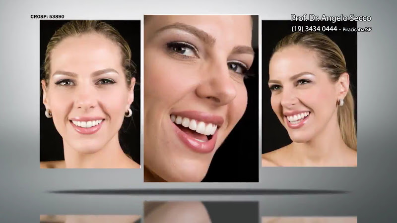 Foto 5 de Dr Angelo Secco