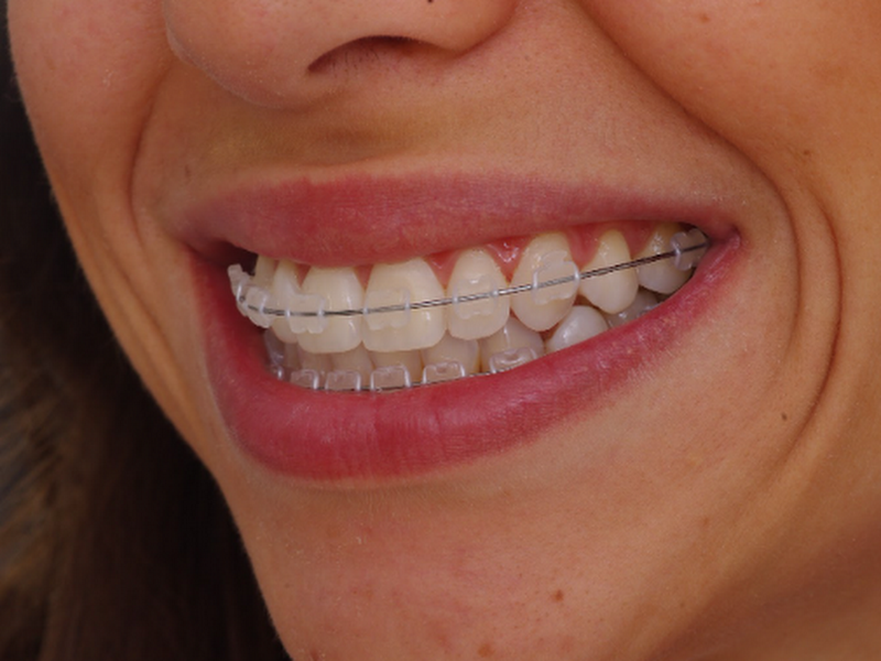 Foto 9 de Dr Angelo Secco