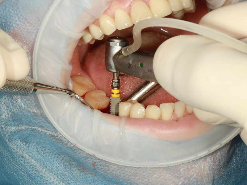 Foto de Dr. Antenor Vieira - Cirurgião-dentista