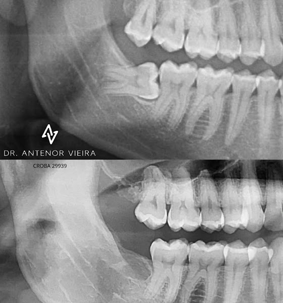 Foto 3 de Dr. Antenor Vieira - Cirurgião-dentista