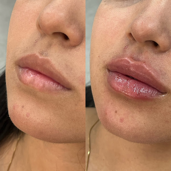 Foto 3 de DR ANTÔNIO FEITOSA | ODONTOLOGIA E HARMONIZAÇÃO FACIAL