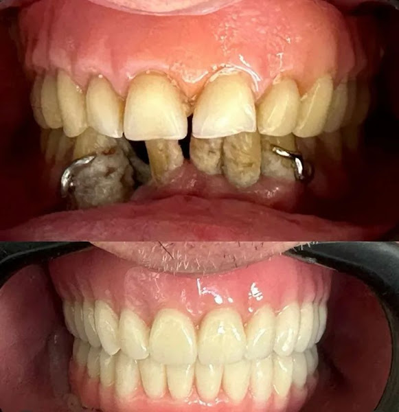 Foto 2 de Dr. Arthur Mansur: Implantes Dentários
