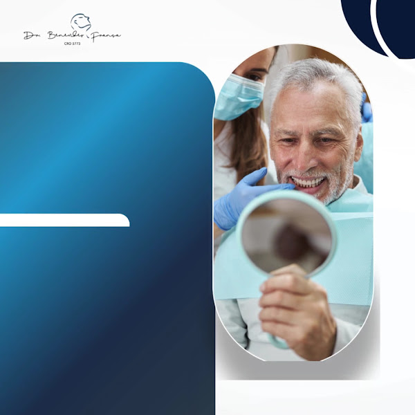 Foto 3 de Dr. Benevides França - Cirurgião buco maxilo BMF