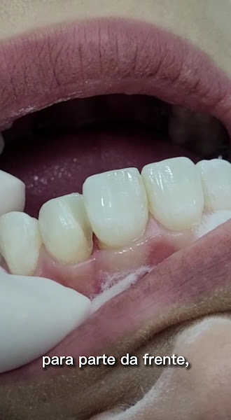 Foto 4 de Dr. Benjamin Amaral - Studio Dentístico