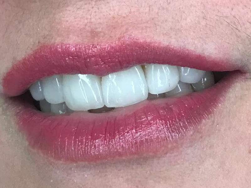 Foto 4 de Dr. Bill Rola