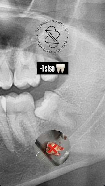 Foto 3 de Dr Brenndon Andrade - Dentista em Juazeiro do Norte-CE