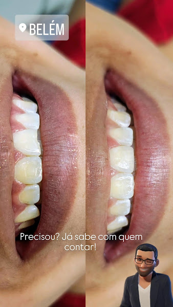 Foto 3 de Dr Breno Oliveira - Odontologia Humanizada