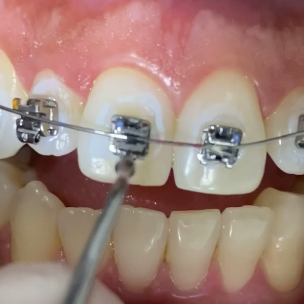 Foto 3 de Dr Breno Peres