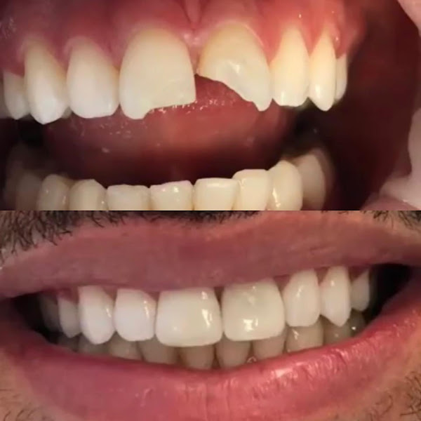 Foto 3 de Dr. Breno Rios Fernandes Odontologia