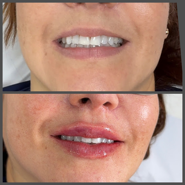 Foto 3 de Drª Bruna Muniz - Estética Avançada Facial - Harmonização Facial - Corporal no Alípio de Melo