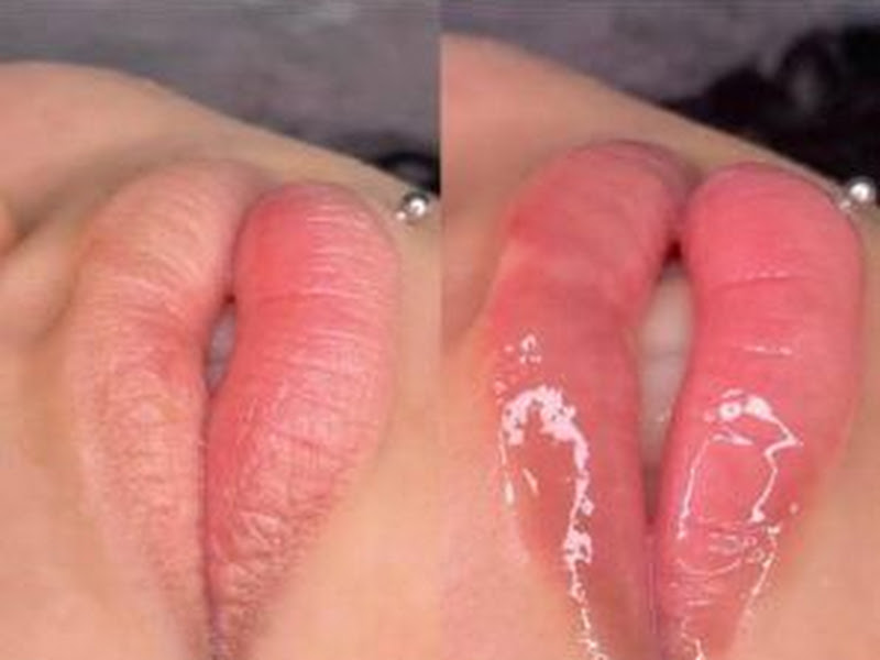 Foto 8 de Dr. Brunno Mororó Implantes Dentários