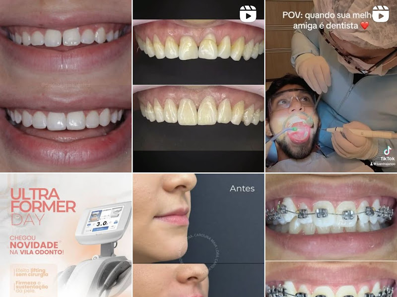 Foto 9 de Dr. Brunno Mororó Implantes Dentários