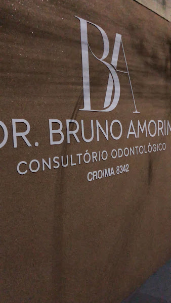 Foto 3 de Dr Bruno Amorim - Faceta em resina