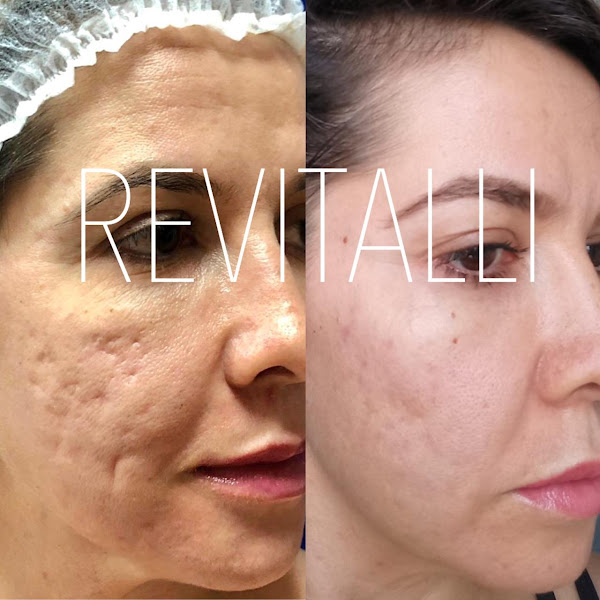 Foto 3 de Dr. Bruno Conte Andre - Harmonização Orofacial