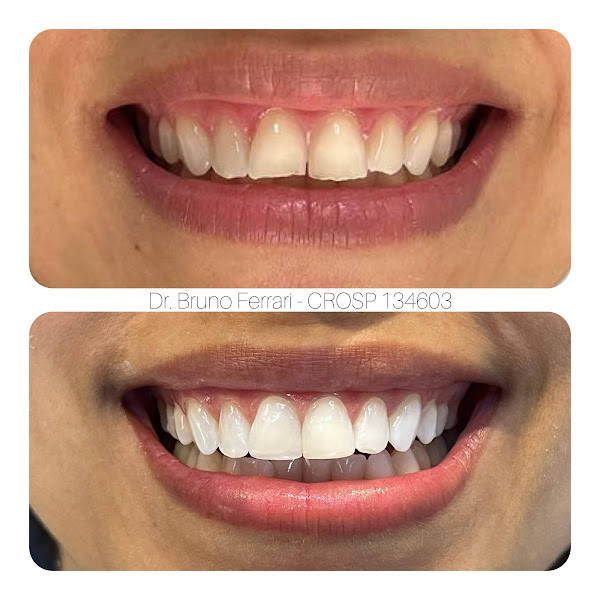 Foto 3 de Dr. Bruno Ferrari