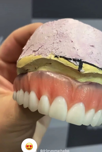 Foto 3 de Dr. Bruno Machado l Dentista - Implantes - Clínica Geral