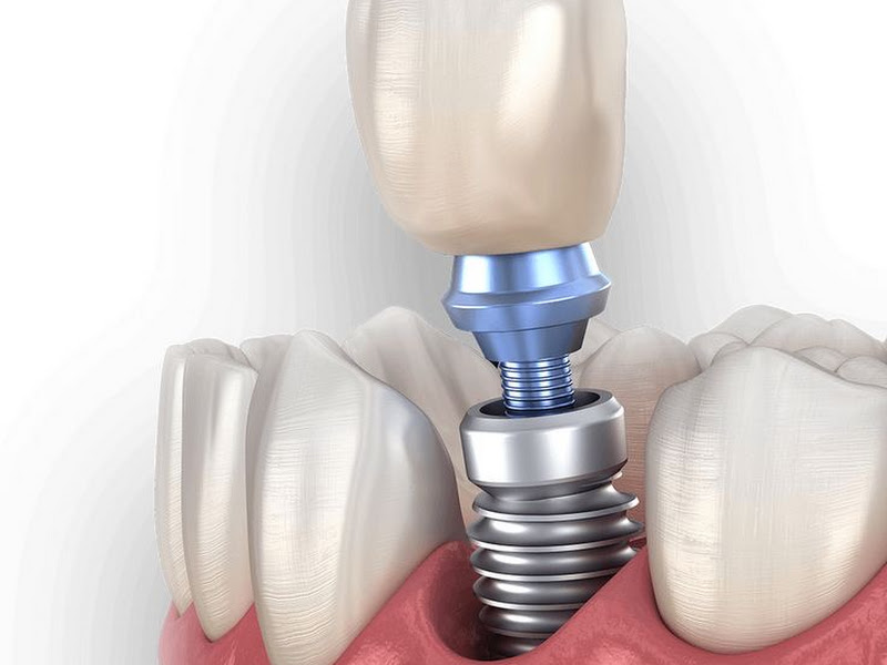 Foto de Dr. Bruno Malcher - Implantes e aparelho ortodôntico em Belém