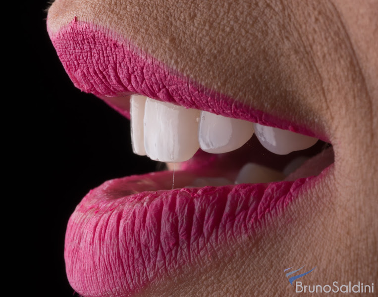 Foto 3 de Dr. Bruno Saldini | Reabilitação Estética e Odontologia Atemporal em Moinhos de Vento – Porto Alegre