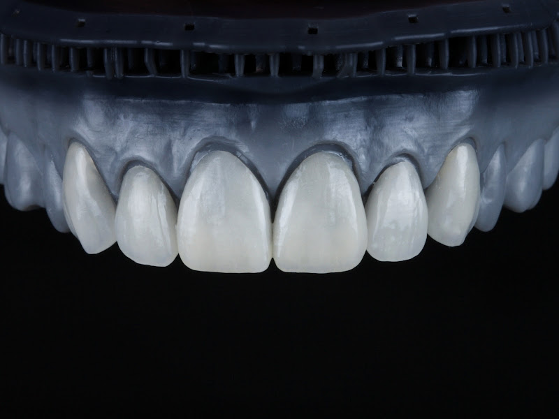 Foto 2 de Dr. Bruno Salgueiro - Dentista Nova Friburgo