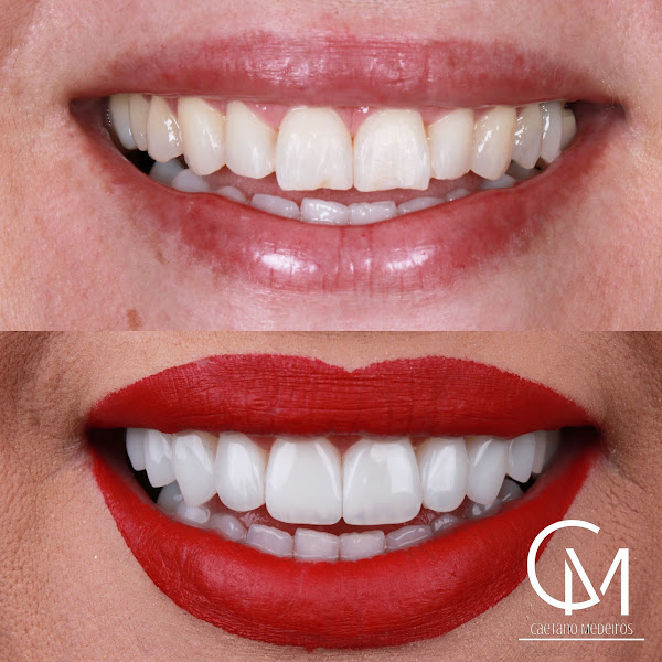 Foto 2 de Dr. Caetano Medeiros