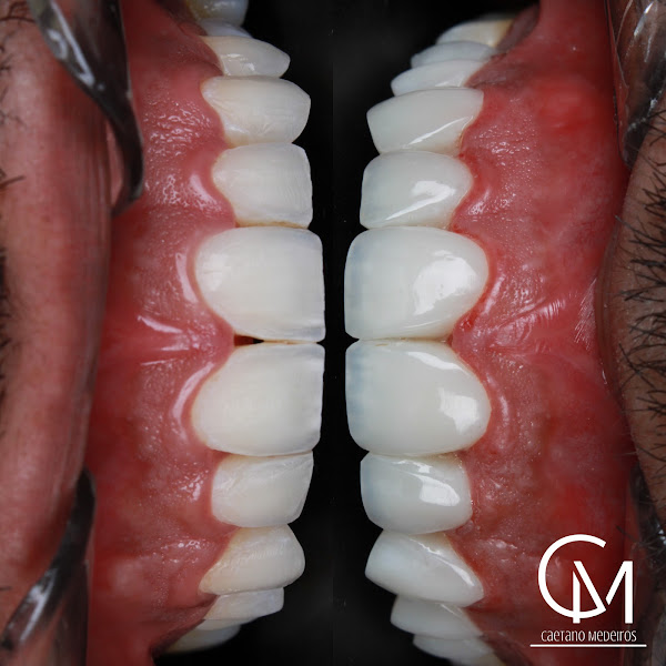 Foto 3 de Dr. Caetano Medeiros