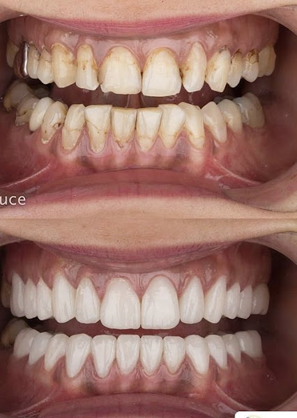 Foto 2 de Dr Caetano Pontes Implantes Dentários & Estética- Centro Odontológico Oral Face