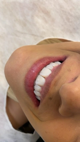 Foto 3 de Dr. Caio Alberto De Lima Cirurgião-Dentista