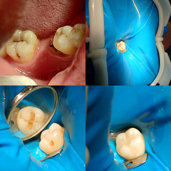 Foto 3 de Dr. Canal Clínica Odontológica