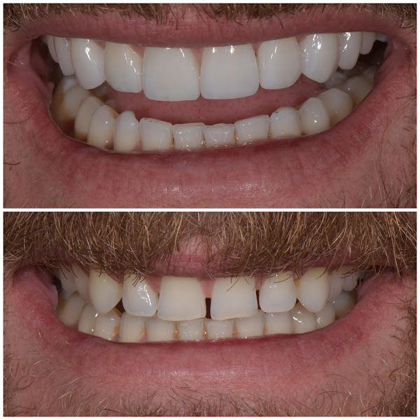 Foto 3 de Dr. Carlo Lago - Cirurgião Dentista