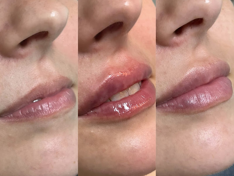 Foto 7 de Dr. Carlo Lago - Cirurgião Dentista