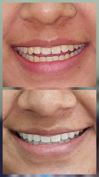 Foto 3 de Dr. Carlos Cabral | Implantes Dentários | Reabilitação Oral em Manaus