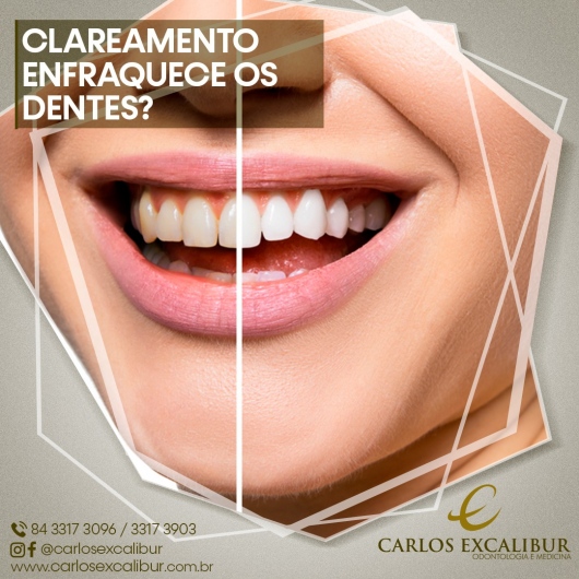Foto 3 de Dr. Carlos Excalibur, Dentista