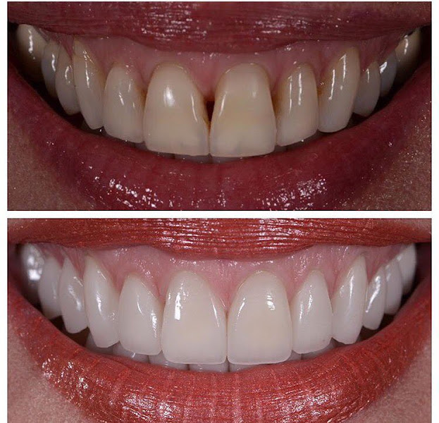 Foto 2 de Dr.Carlos Morais | Invisalign | Aparelho Fixo e Estético | Piracicaba