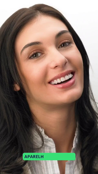 Foto 3 de Dr.Carlos Morais | Invisalign | Aparelho Fixo e Estético | Piracicaba