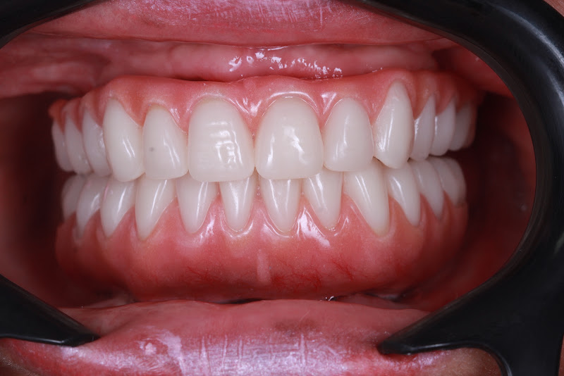 Foto 2 de DR CARLOS SEGUNDO - ODONTOLOGIA ESTÉTICA E IMPLANTES DENTÁRIOS