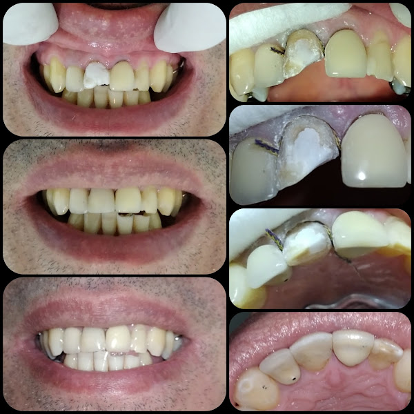 Foto 2 de Dr Célio Lopes Consultório Odontológico